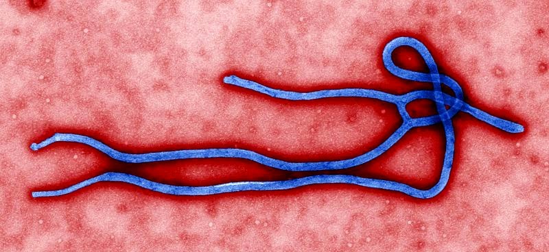  Ebola  virus virion Nutrition Health Wellness