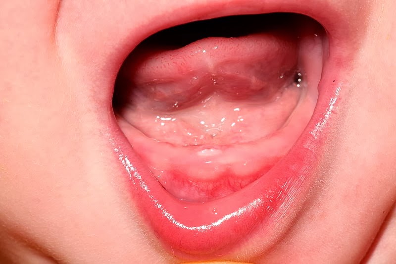 Primary lower central incisor emerging from the gum Nutrition, Health